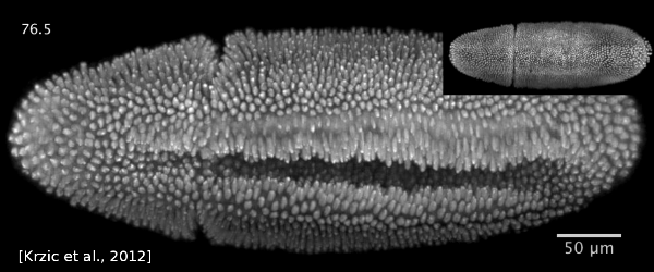 Drosophila